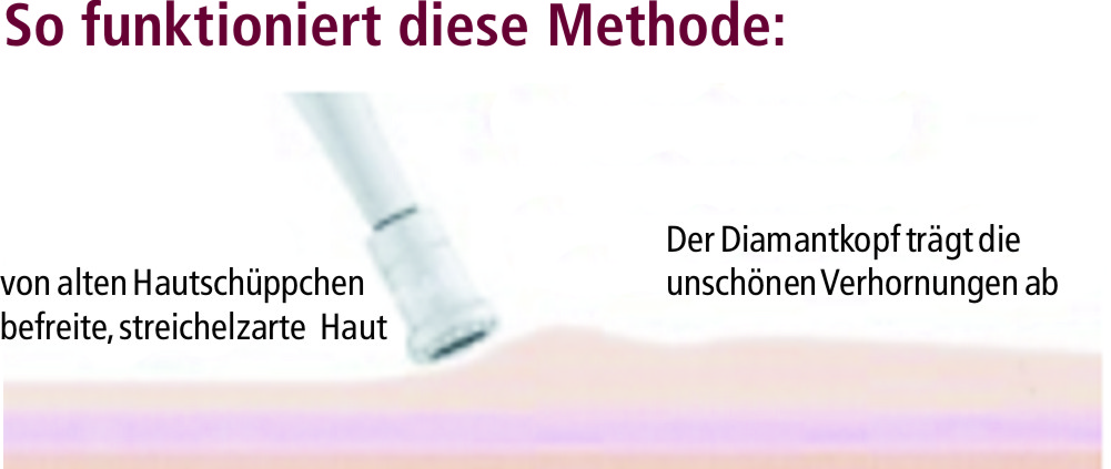 Diamant Mikrodermabrasion - Skinline Cosmetics - Kosmetikstudio Offenbach am Main